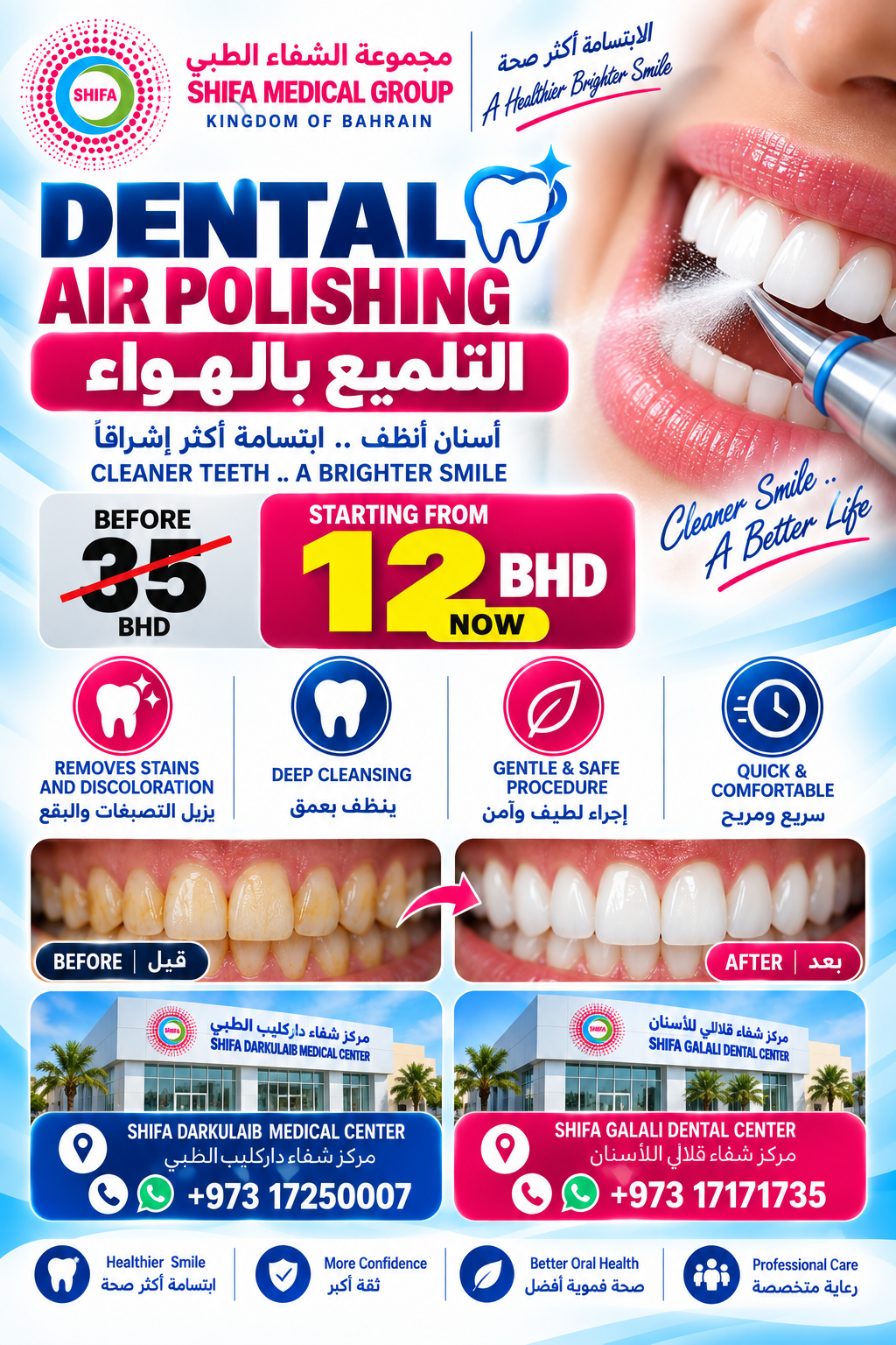 Dental Air Polishing offer