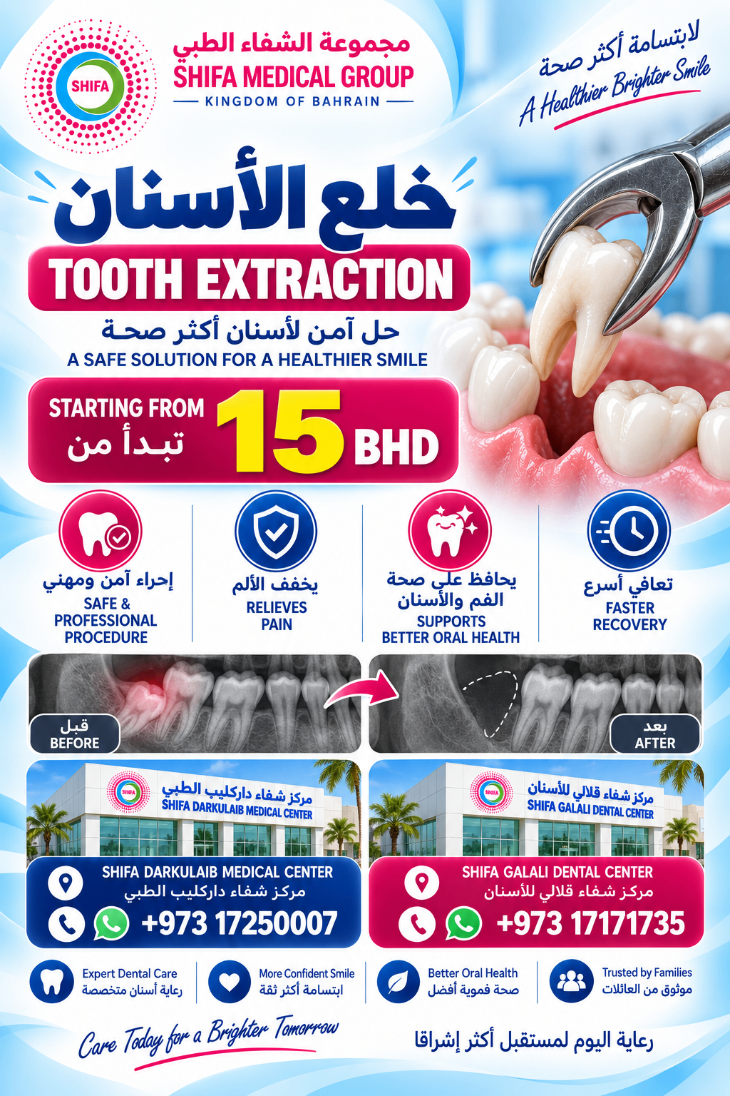 Tooth Extraction offer