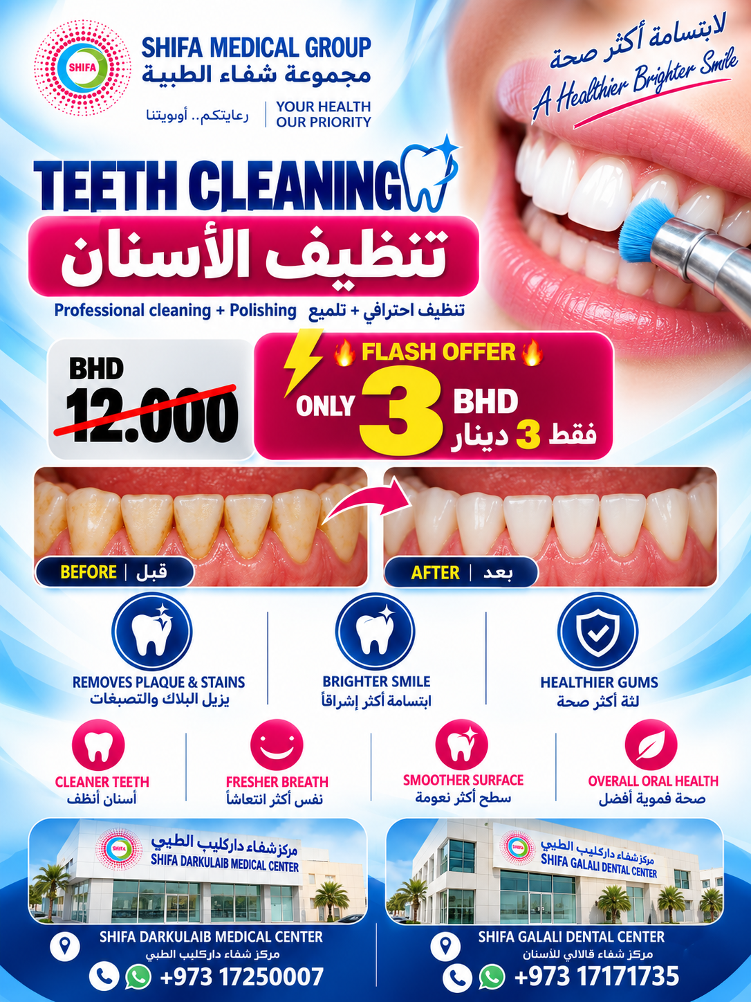 Teeth Cleaning & Polishing offer