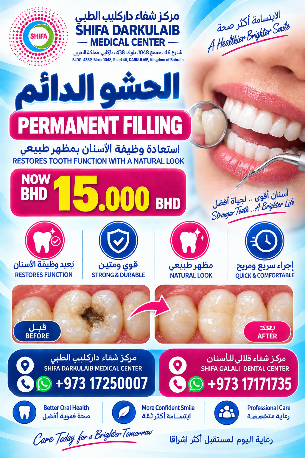 Permanent Filling offer