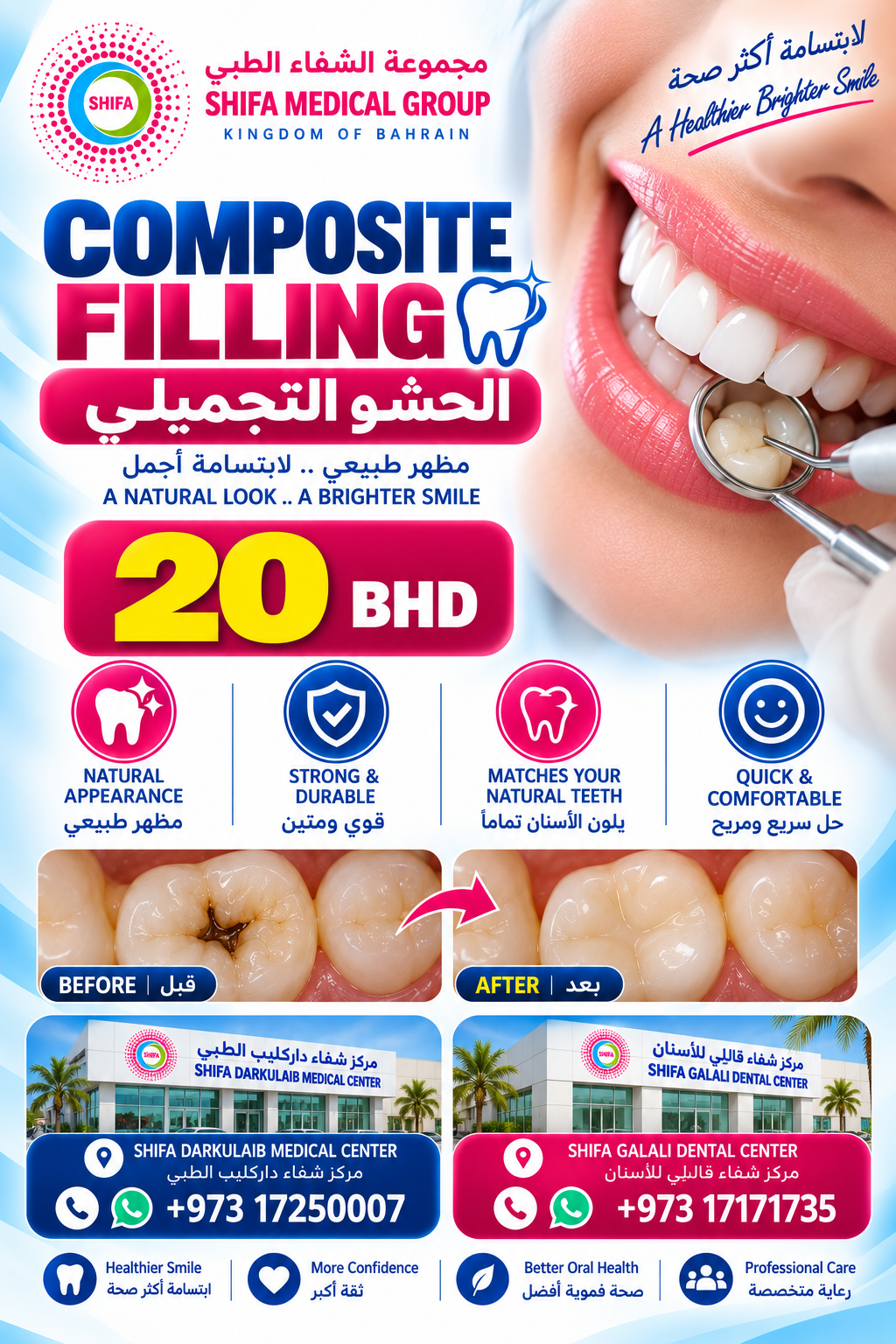 Composite Filling offer