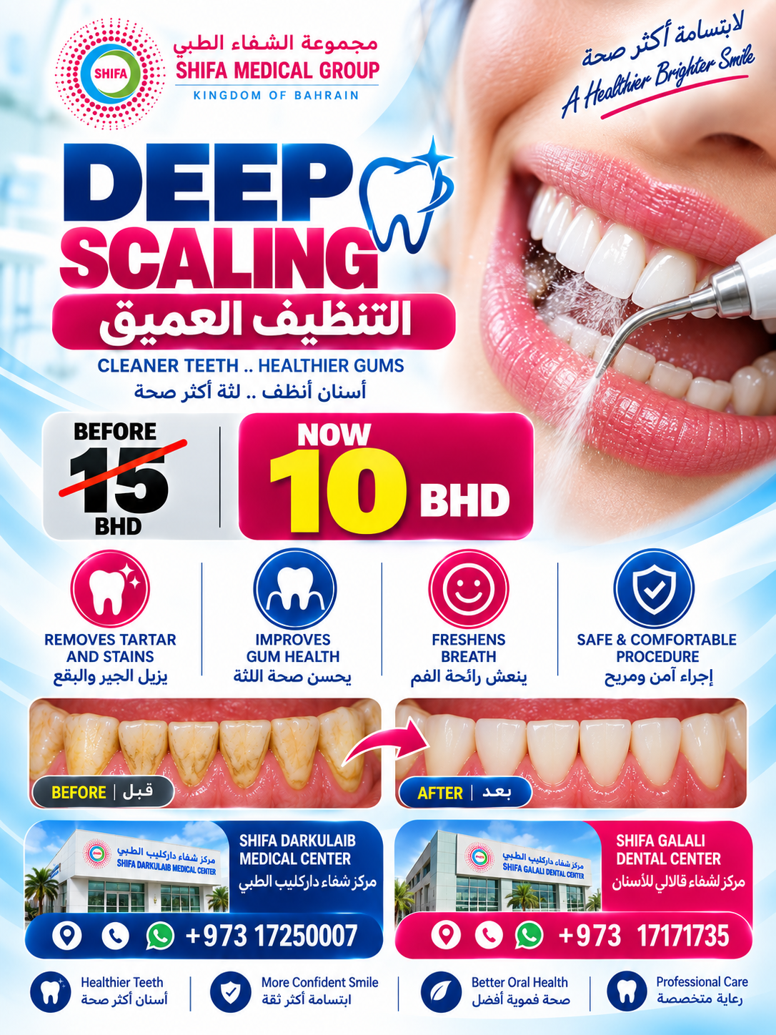 Deep Scaling offer